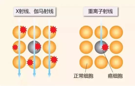 質(zhì)子重離子技術(shù)醫療險可以報銷(xiāo)嗎？
